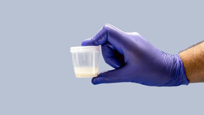 Cercasi sperma di uomo non&nbsp;vaccinato